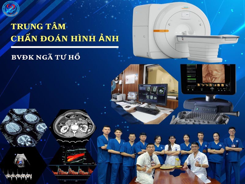 khoa-chan-doan-hinh-anh-benh-vien-da-khoa-nga-tu-ho
