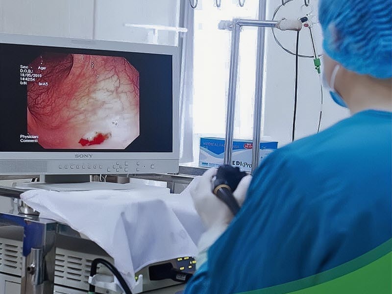 Nội soi dạ dày: Có đau không? Cần chuẩn bị gì? noi-soi-da-day-tai-benh-vien-nga-tu-ho-2