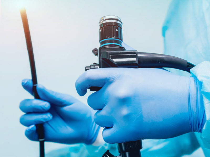 Nội soi dạ dày: Có đau không? Cần chuẩn bị gì? noi-soi-da-day-tai-benh-vien-nga-tu-ho-4