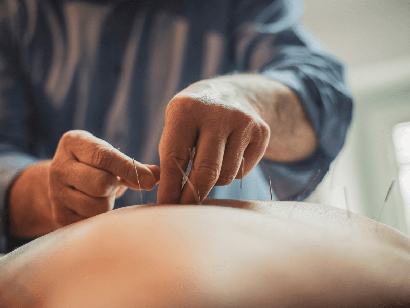 dieu-tri-dau-xuong-khop-bang-phuong-phap-cham-cuu