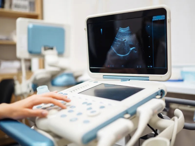 Nên siêu âm thai định kỳ mấy tuần 1 lần? nen-sieu-am-thai-dinh-ky-may-tuan-1-lan-1