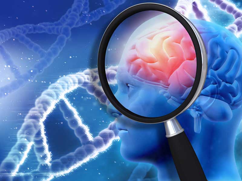 Sự nguy hiểm của tai biến mạch máu não cần biết nguyen-nhan-gay-ra-tai-bien-mach-mau-nao