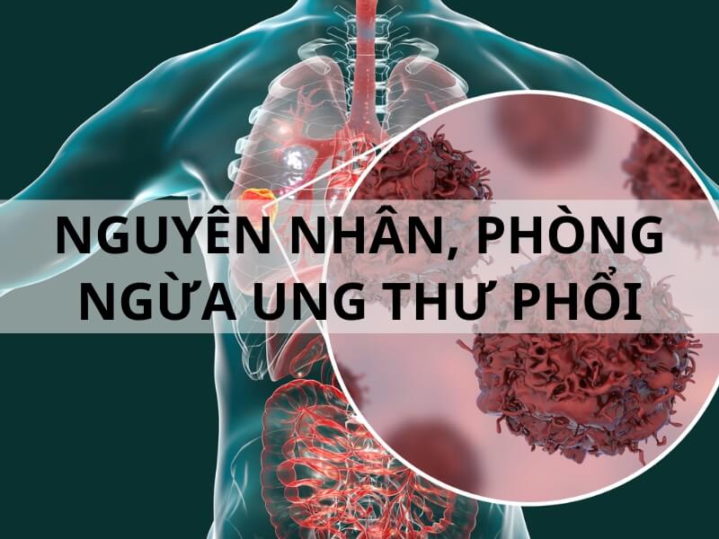 cac-bien-phap-phong-ngua-ung-thu-phoi-hieu-qua
