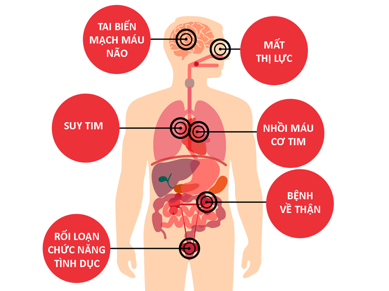 benh-vien-nga-tu-ho-dia-chi-kham-huyet-ap-tot-nhat-bac-ninh