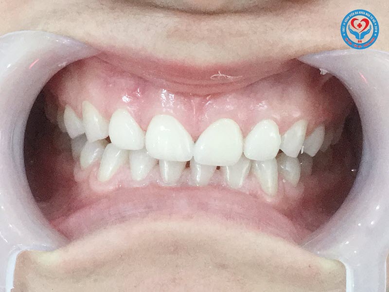 benh-vien-nga-tu-ho-dia-chi-kham-va-dieu-tri-nha-khoa-uy-tin-nhat-bac-ninh