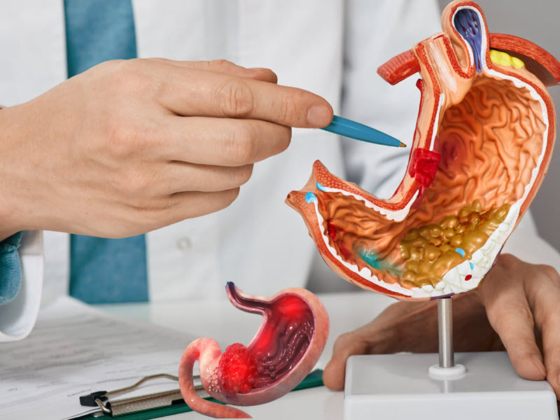 benh-vien-nga-tu-ho-dia-chi-noi-soi-da-day-uy-tin