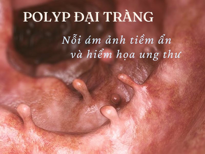 benh-vien-nga-tu-ho-dia-chi-noi-soi-dai-trang-tot-nhat-bac-ninh