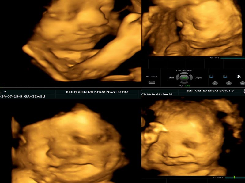 benh-vien-nga-tu-ho-dia-chi-sieu-am-thai-chinh-xac-nhat-bac-ninh