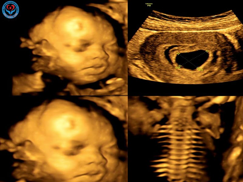 benh-vien-nga-tu-ho-dia-chi-sieu-am-thai-uy-tin-tai-bac-ninh