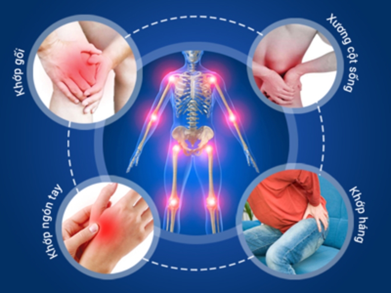 benh-vien-nga-tu-ho-dia-chi-kham-va-dieu-tri-benh-xuong-khop-tot-nhat-bac-ninh