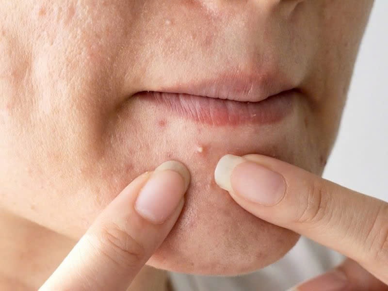 benh-vien-nga-tu-ho-dia-chi-lay-nhan-mun-tai-bac-ninh