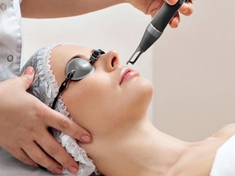 cham-soc-da-lieu-sau-dieu-tri-laser-hoac-peel-da-2