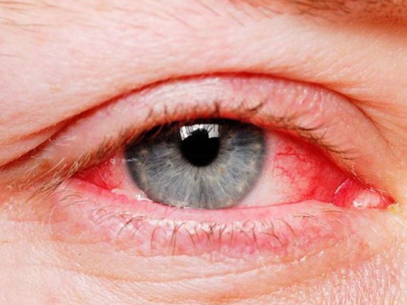 kham-va-dieu-tri-cac-benh-ve-mat-2