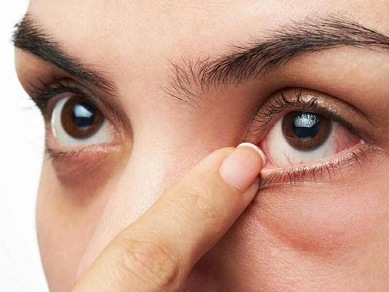 kham-va-dieu-tri-cac-benh-ve-mat