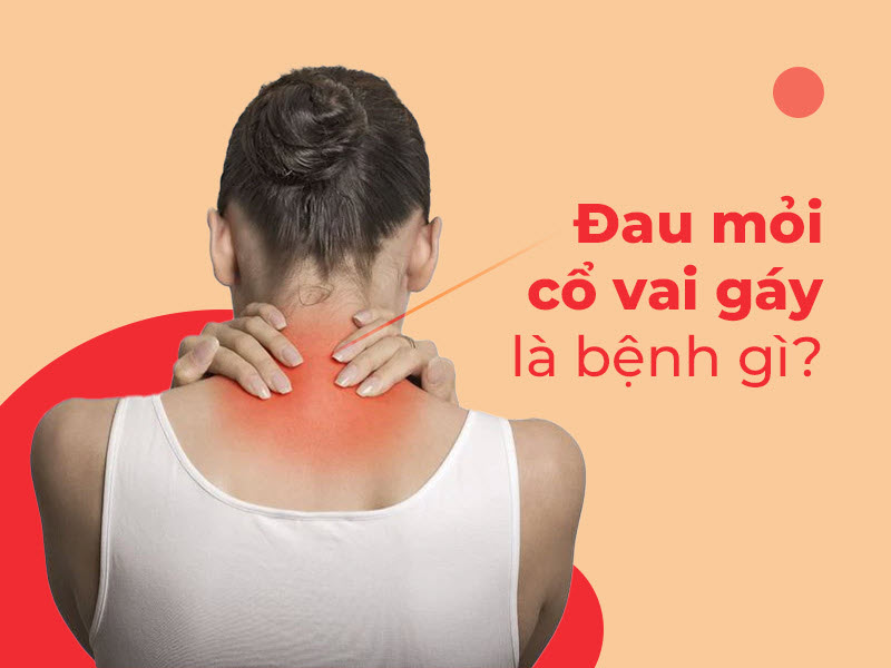 Khám và điều trị đau vai gáy mãn tính kham-va-dieu-tri-dau-vai-gay-man-tinh