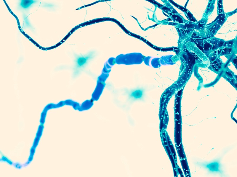 liet-day-than-kinh-mat-liet-bell