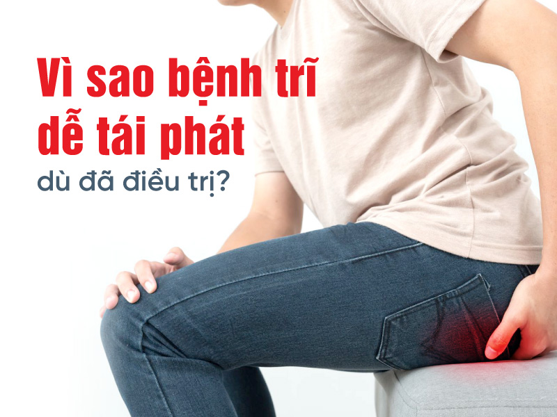 Bệnh trĩ – Nguyên nhân, triệu chứng và phương pháp điều trị hiệu quả vi-sao-benh-tri-de-tai-phat