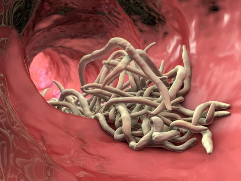 cach-phong-tranh-giun-kim-o-tre-em