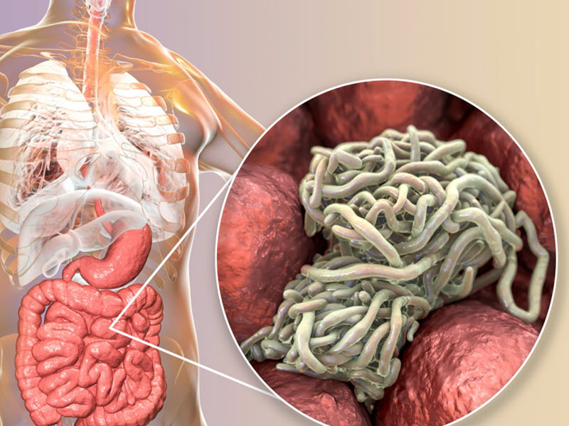 nguyen-nhan-dan-den-tre-bi-giun-kim