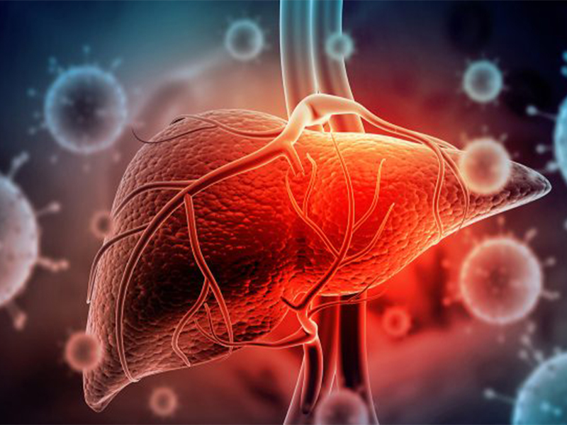 Phát hiện sớm bệnh gan qua xét nghiệm máu – chìa khóa bảo vệ sức khỏe lá gan phat-hien-som-benh-gan-qua-xet-nghiem-mau