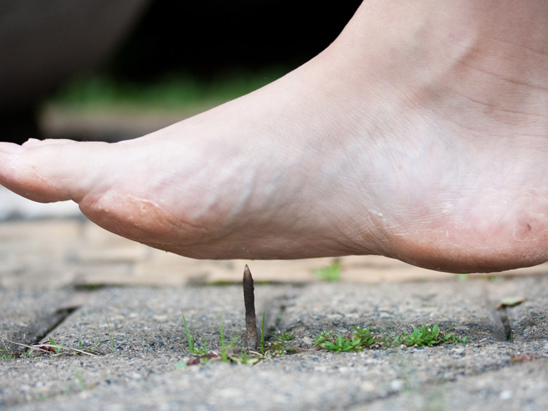 Bệnh uốn ván: Nguyên nhân, triệu chứng, biến chứng và cách phòng ngừa hiệu quả tai-sao-lai-mac-benh-uon-van