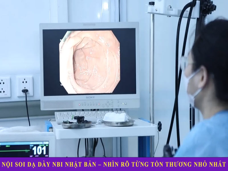 noi-soi-da-day-nbi-nhat-ban