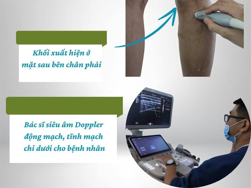 Siêu âm Doppler là gì? Khi nào cần thực hiện và có quan trọng không? bvdk-nga-tu-ho-dia-chi-sieu-am-doppler-tai-bac-ninh