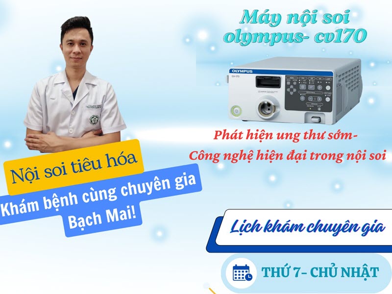 noi-soi-kiem-tra-suc-khoe-da-day