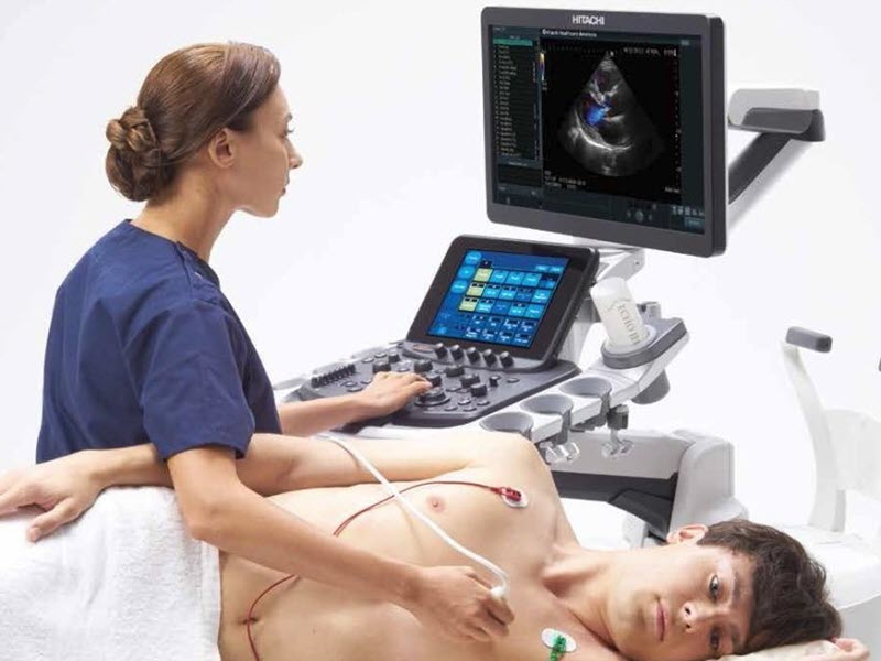 phuong-phap-sieu-am-tim-hien-nay