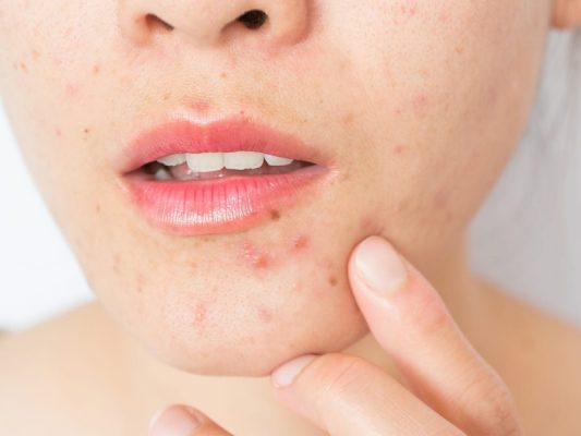 benh-vien-nga-tu-ho-dia-chi-kham-va-dieu-tri-benh-da-lieu-tot-nhat-bac-ninh