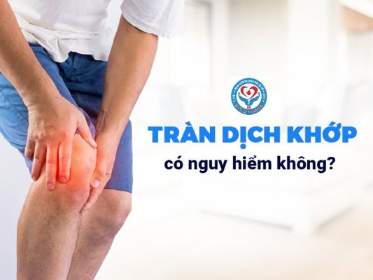 su-nguy-hiem-cua-tran-dich-khop-goi